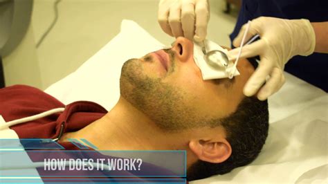 Laser Hair Removal For Men Harley Street Cosmetic Clinic Youtube