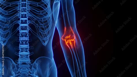 3d Rendered Medical Illustration Of Male Anatomy Inflamed Elbow