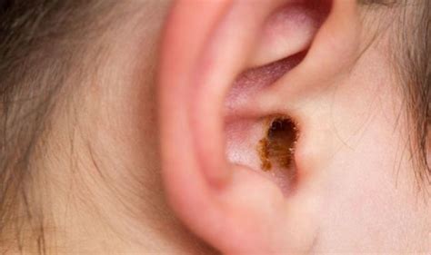 How To Clean Your Ears Ear Wax The Correct And Safe Way