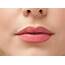 Pucker Up For Information About Your Beautiful Lips  Arlington Heights IL