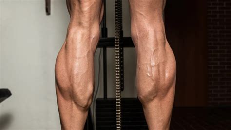 Bad Leg Genetics Do The Bodybuilding Genetics Insertion Test Calves And Quads