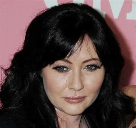Shannen Doherty Plastic Surgery Before And After Botox Injections Celebie