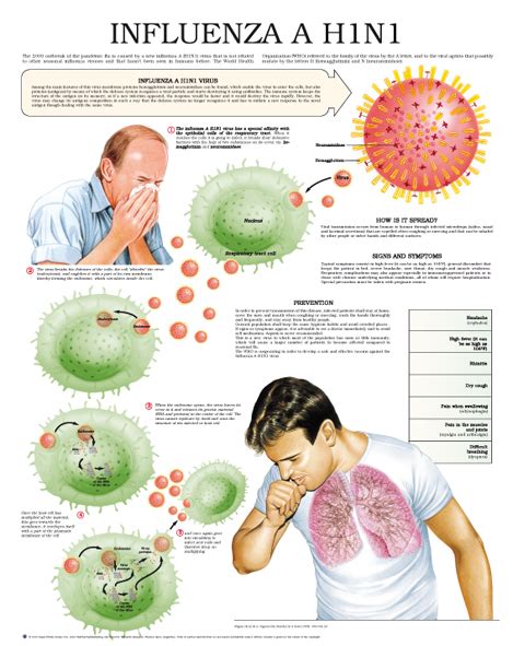 What Is H1n1 Swine Flu Spot Of Health