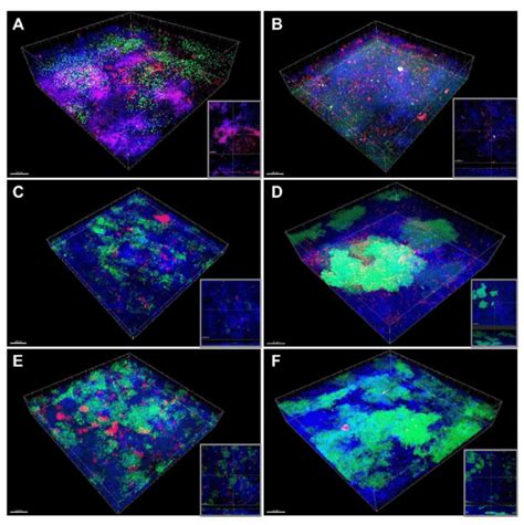 Confocal Laser Scanning Microscopy Clsm 3d Reconstructions And Image