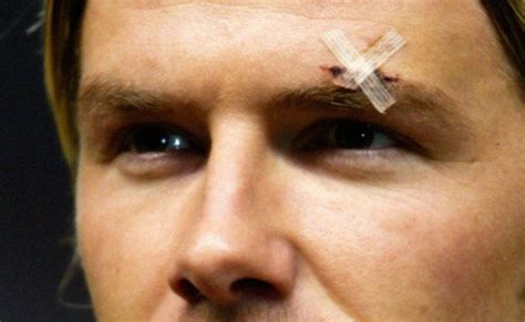 5 Surprisingly Weird Injuries Suffered By Sports Stars Huffpost Uk News