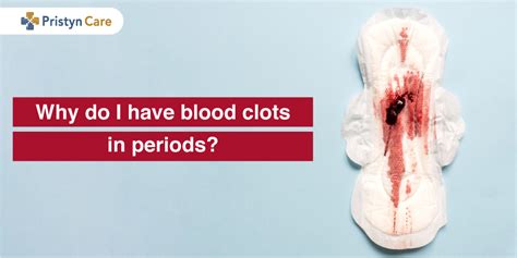 Heavy Blood Clotting During Periods