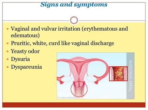 Infections During Pregnancy