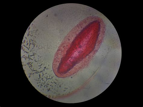 Fileparamecium Undergoing Cyst Formation Wikimedia Commons