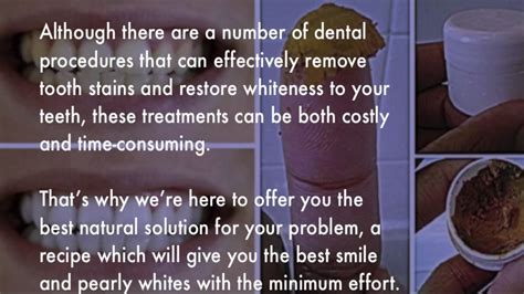 Be Your Own Dentist Heal Cavities Gum Disease And Whiten Teeth