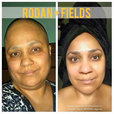 here s what sandy said about using reverse after months of chemo wreaked havoc… rodan and