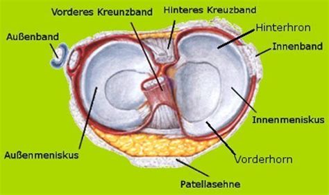 Die kernspintomographische untersuchung ergab im vergleich zum operativen befund für. Der Meniskusriss: Eine unterschätzte Knieverletzung Knie ...