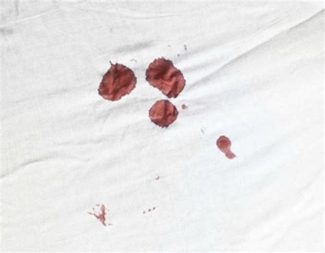Period Blood Clots Smell And Colour What Your Period Is Telling You