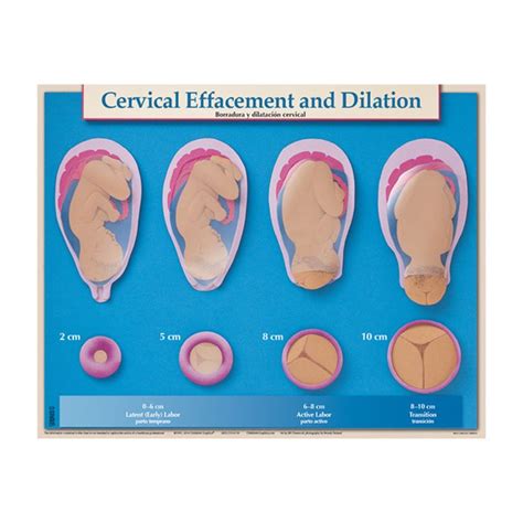 Cervical Effacement And Dilation Chart Cervical Effacement Dilations Cervical