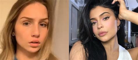 Womans Bizarre Hack To Get Kylie Jenner Lips Goes Viral Lmfm