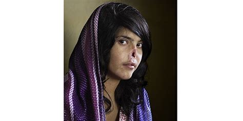 Picture Of Disfigured Afghan Woman Wins World Press Photo