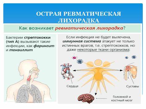 Ревматическая хорея диета Острая ревматическая лихорадка - презентация онлайн Острая ревматическая лихорадка - презентация онлайн Ревматическая хорея диета