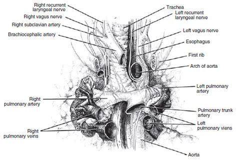 Pulmonary Embolism Case File