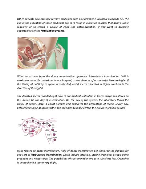 Sperm Donor Iui Intrauterine Insemination Fertility Centers