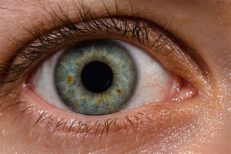 Filehuman Eye With Blood Vessels Wikimedia Commons