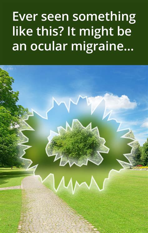 Ocular Migraines Explained All About Vision Ocular Migraine