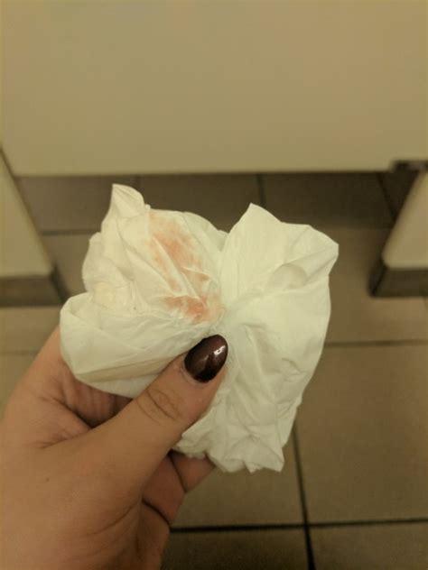 Implantation Bleeding In Toilet