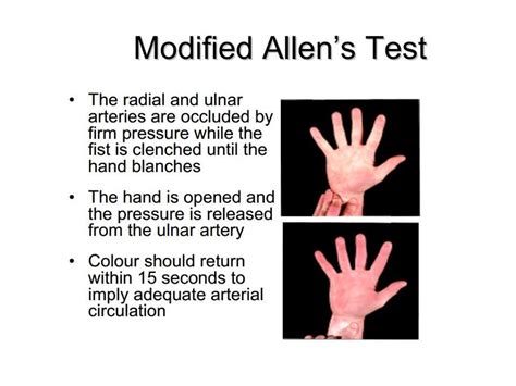 While no active threats were reported recently by users, allentest.com is safe to browse. Ganglion Cyst of the Wrist and Hand | Dr. Gordon Groh