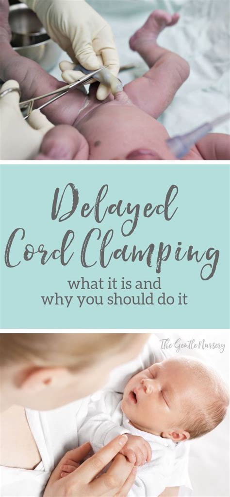 The Important Health Benefits Of Delayed Umbilical Cord Clamping Delayed Cord Clamping Cord