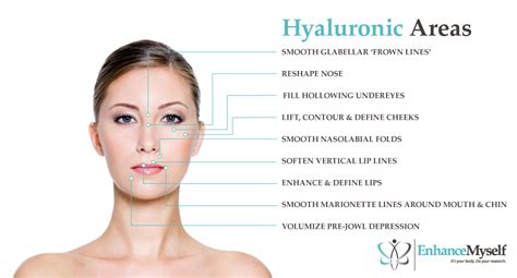Cost Of Hyaluronic Acid Dermal Fillers Types Benefits Results