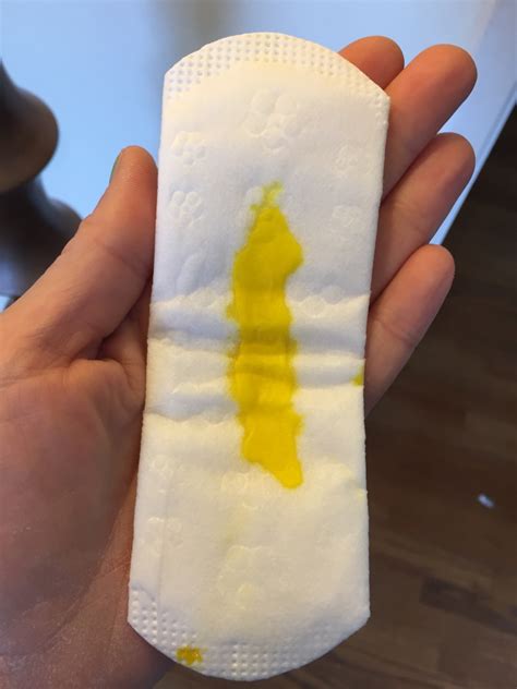 How Much Vaginal Discharge Is Normal I Made A Roux To Demonstrate