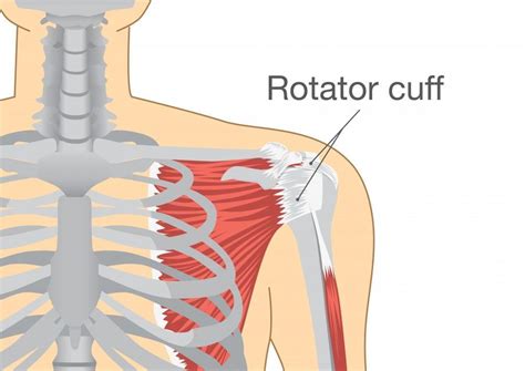 4 Signs Of A Rotator Cuff Tear Orthopedic Center Of Arlington