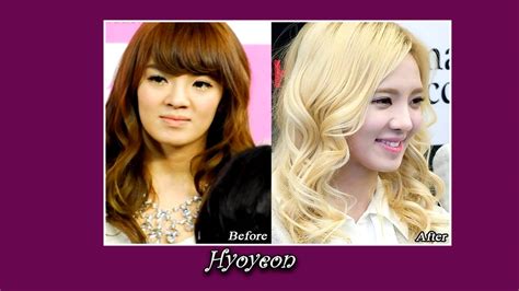 12 Kpop Stars Before After Plastic Surgery Mix Show Youtube