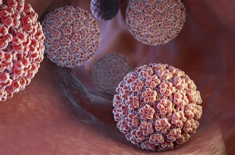 Imagens De Verrugas De Hpv