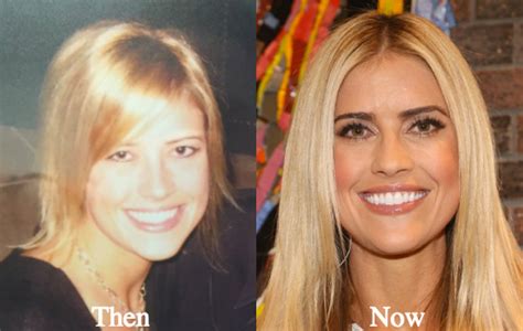Christina El Moussa Plastic Surgery Rumors Before And After Comparison