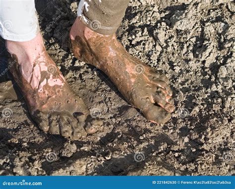 Muddy Feet Of A Young Woman Stock Photo Image Of Gray Challenge