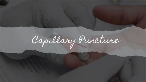 Capillary Puncture Return Demonstration Youtube