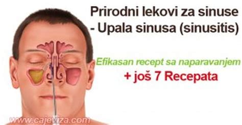 Prirodni Lijekovi Za Sinuse Sinusitis 7 Recepata Lijek Iz Prirode