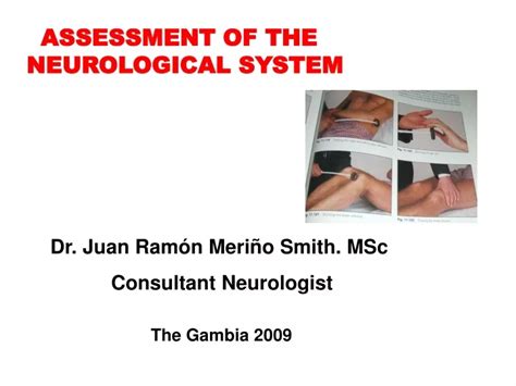Ppt Assessment Of The Neurological System Powerpoint Presentation