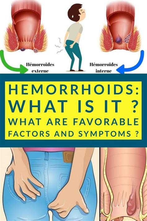 Internal Hemorrhoids Stomach Pain Colon Cancer Vs Hemorrhoid Symptoms