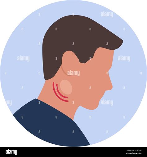 Man With Swollen Lymph Nodes Isolated Icon Stock Vector Image And Art Alamy
