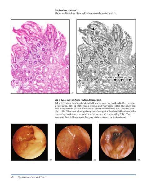 Atlas Of Gastrointestinal Endoscopy And Related Pathology Blackwell