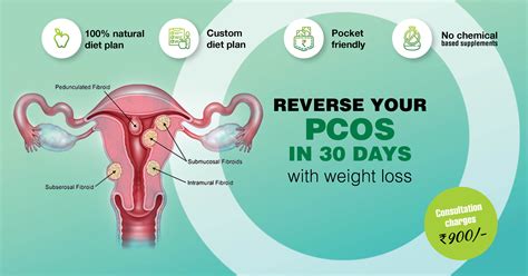 reverse your pcos in 30 days diet plan to lose weight for pcos