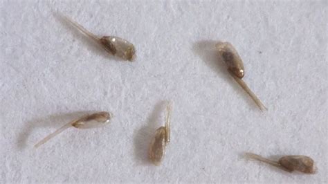 How To Identify Lice And Nits Lice Eggs