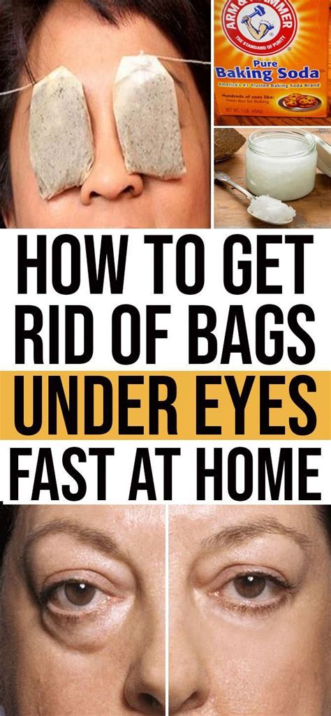 Awasome How To Remove Bags Under The Eye References Beauty Shop