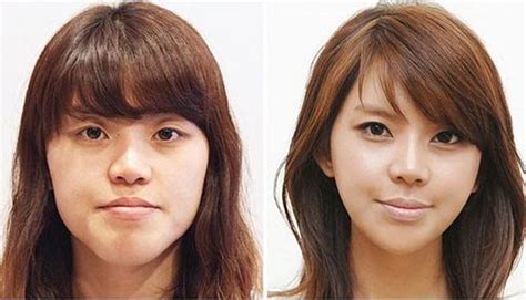 Everyone who had surgery on the show became really popular. Before and After Photos of Korean Plastic Surgery. Part 2 ...