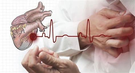 7 Things About Arrhythmia Or Irregular Heartbeat That You Need To Know