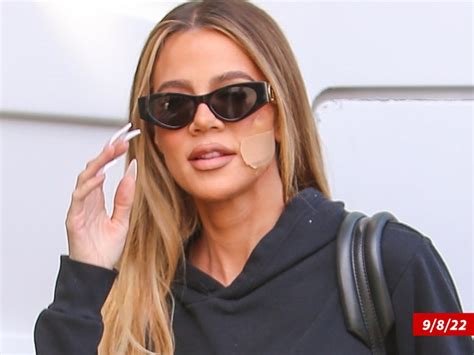 khloe kardashian reveals skin cancer scare tumor removed from face hot lifestyle news