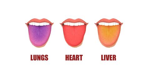 What Your Tongue Color Says About Your Health Youtube