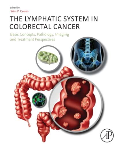 The Lymphatic System In Colorectal Cancer Basic Concepts Pathology