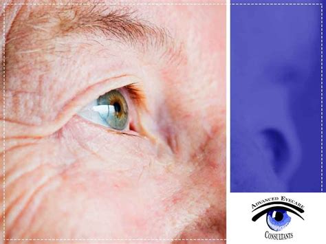Age Related Macular Degeneration Eye Doctor In Libertyville Il