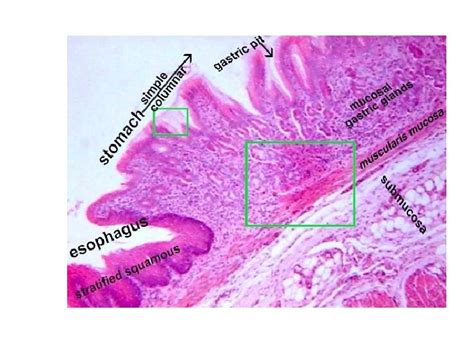 Histology Of Esophagus Gastro Esophageal Junction By Dr